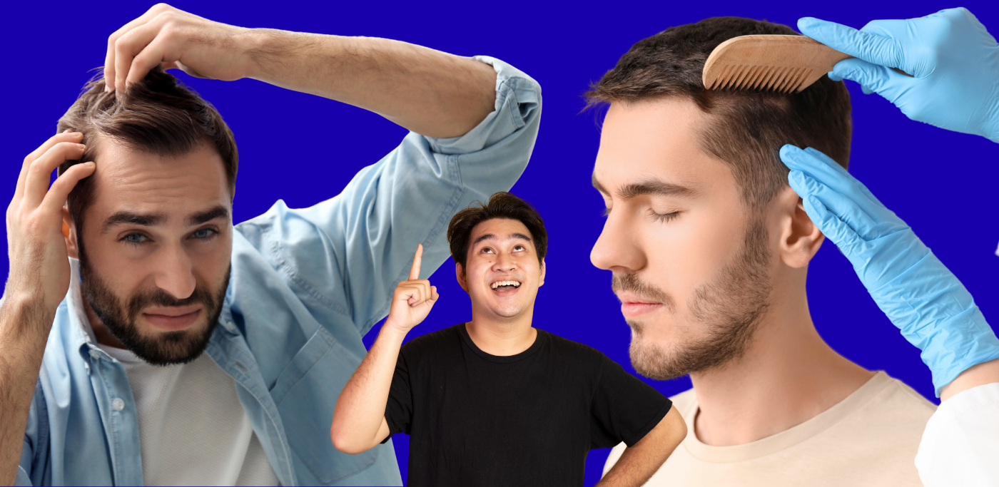 Best Hair Transplant Clinic in Delhi