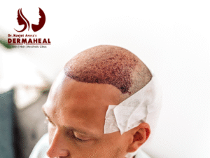 Best Dermatologist in Dwarka for Skin and Hair Care