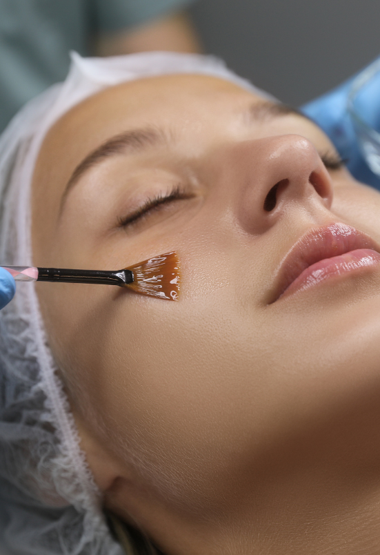 Chemical Peeling in Dwarka – Restore Glow and Confidence