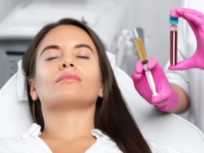 Face PRP Treatment: Rejuvenate Your Skin Naturally
