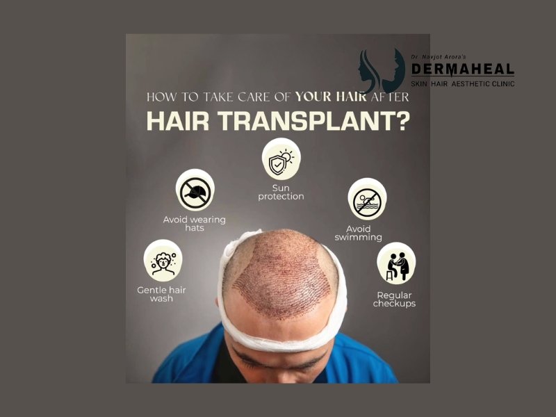 Discover the Best Hair Transplant Clinic in Dwarka: Dermaheal Skin & Hair Clinic