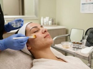 Chemical Peeling Treatment in Dwarka